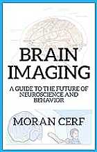 Brain imaging. An illustrated guide to the future of neuroscience